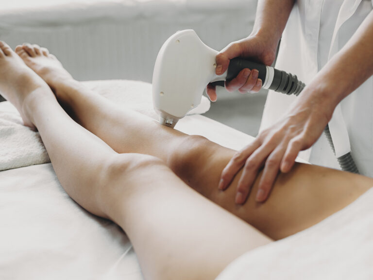 seduta di epilazione laser alle gambe